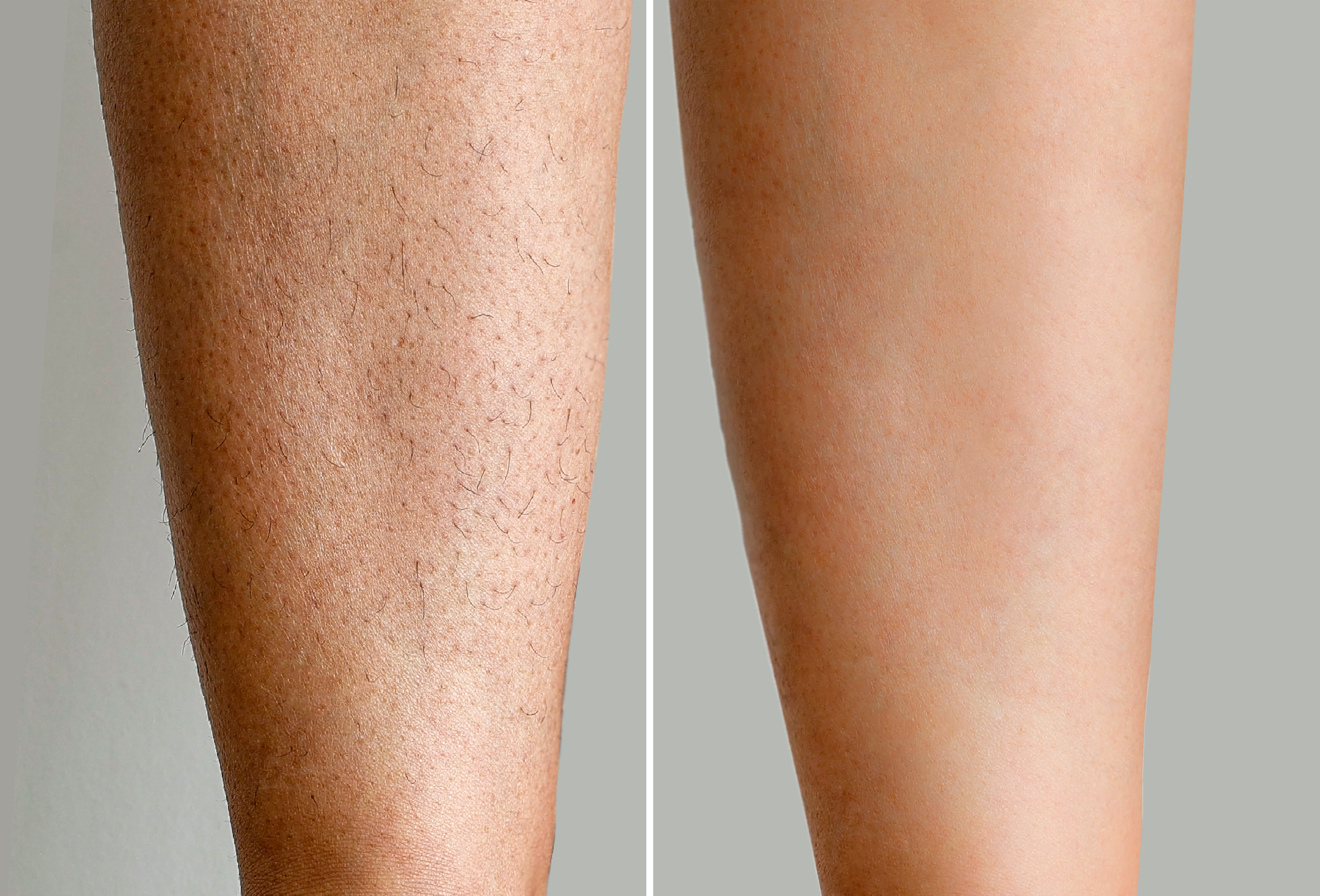 Legs