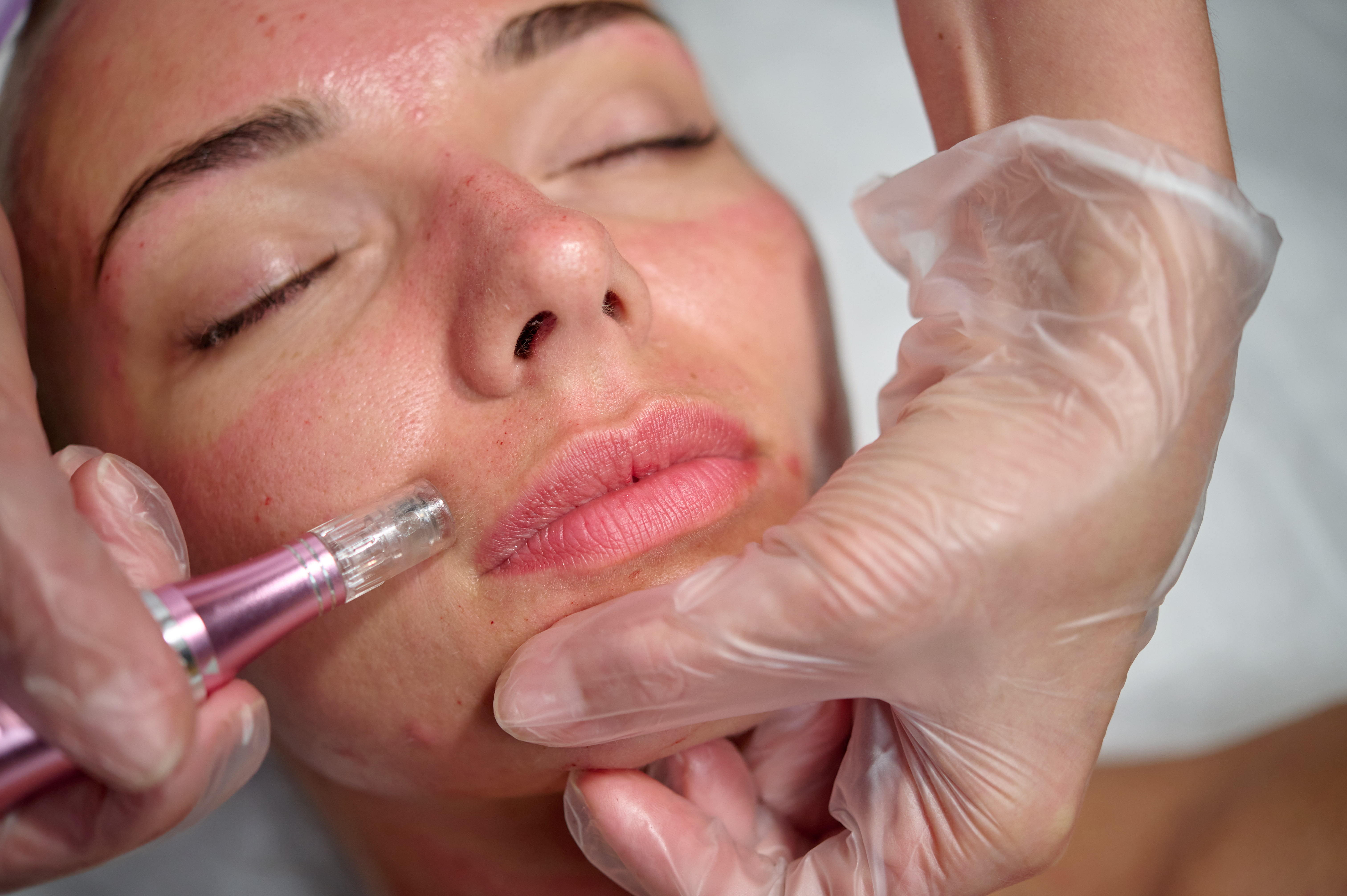 medical-grade Skin Care